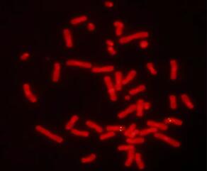 法國(guó)IMSTAR全自動(dòng)熒光原位雜交軟件