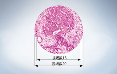 Olympus奧林巴斯顯微鏡官網(wǎng)